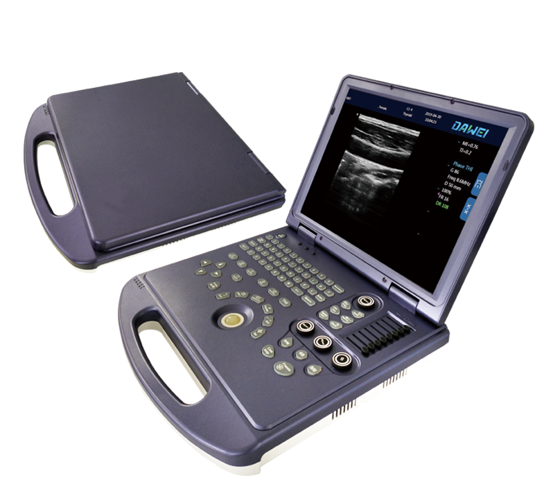 大为便携式全数字超声诊断仪手提式DW-360