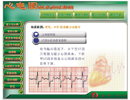 新版心电图教学软件 心电图临床实例解读KAS/XDR